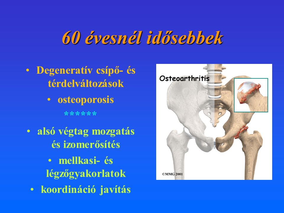 végtag osteoarthritis)